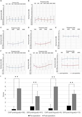 Outcomes of cochlear implantation in 75 patients with auditory neuropathy